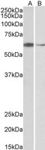 ARIH2 Antibody - ARIH2 / TRIAD1 antibody (2µg/ml) staining of Hela (A) and K562 (B) nuclear lysates (35µg protein in RIPA buffer). Detected by chemiluminescence.