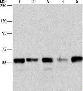 ARIH2 Antibody - Western blot analysis of HeLa, Jurkat, 293T and K562 cell, mouse testis tissue, using ARIH2 Polyclonal Antibody at dilution of 1:550.