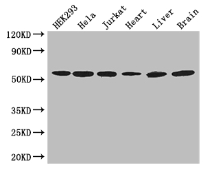 ARIH2 Antibody - Positive WB detected in:HEK293 whole cell lysate,Hela whole cell lysate,Jurkat whole cell lysate,Mouse heart tissue,Mouse liver tissue,Mouse brain tissue;All lanes: ARIH2 antibody at 3ug/ml;Secondary;Goat polyclonal to rabbit IgG at 1/50000 dilution;Predicted band size: 43,36 kDa;Observed band size: 58 kDa;