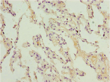 ARIH2 Antibody - Immunohistochemistry of paraffin-embedded human lung tissue at dilution 1:100