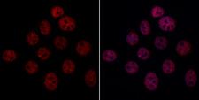 ARIH2 Antibody - Staining HeLa cells by IF/ICC. The sample were fixed with PFA and permeabilized in 0.1% Triton X-100,then blocked in 10% serum for 45 minutes at 25°C. The primary antibody was diluted at 1/200 and incubated with the sample for 1 hour at 37°C. An  Alexa Fluor 594 conjugated goat anti-rabbit IgG (H+L) antibody(Red), diluted at 1/600, was used as secondary antibody.