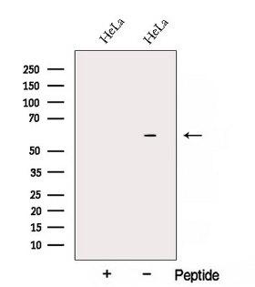 ARIH2 Antibody - Western blot analysis of extracts of HeLa cells using ARIH2 antibody. The lane on the left was treated with blocking peptide.