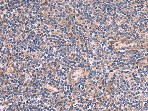 ARIH2 Antibody - Immunohistochemistry of paraffin-embedded Human tonsil tissue  using ARIH2 Polyclonal Antibody at dilution of 1:80(×200)