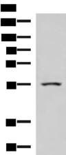 ARIH2 Antibody - Western blot analysis of Human heart tissue lysate  using ARIH2 Polyclonal Antibody at dilution of 1:1000