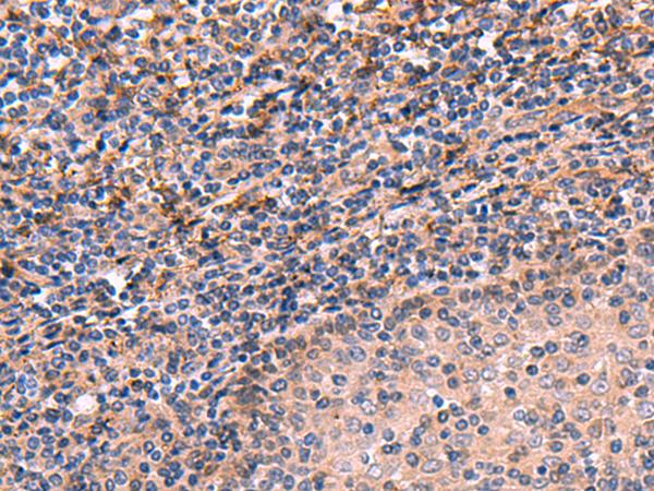 ARIH2 Antibody - Immunohistochemistry of paraffin-embedded Human tonsil tissue  using ARIH2 Polyclonal Antibody at dilution of 1:70(×200)