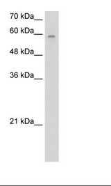 ARIH2 Antibody - Jurkat Cell Lysate.  This image was taken for the unconjugated form of this product. Other forms have not been tested.