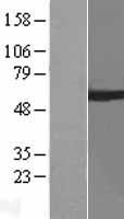 ARIH2 Protein - Western validation with an anti-DDK antibody * L: Control HEK293 lysate R: Over-expression lysate