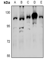 Arkadia / RNF111 Antibody - Western blot analysis of RNF111 expression in Hela (A), A549 (B), MCF7 (C), CT26 (D), PC12 (E) whole cell lysates.