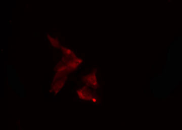 Arkadia / RNF111 Antibody - Staining LOVO cells by IF/ICC. The samples were fixed with PFA and permeabilized in 0.1% Triton X-100, then blocked in 10% serum for 45 min at 25°C. The primary antibody was diluted at 1:200 and incubated with the sample for 1 hour at 37°C. An Alexa Fluor 594 conjugated goat anti-rabbit IgG (H+L) antibody, diluted at 1/600, was used as secondary antibody.