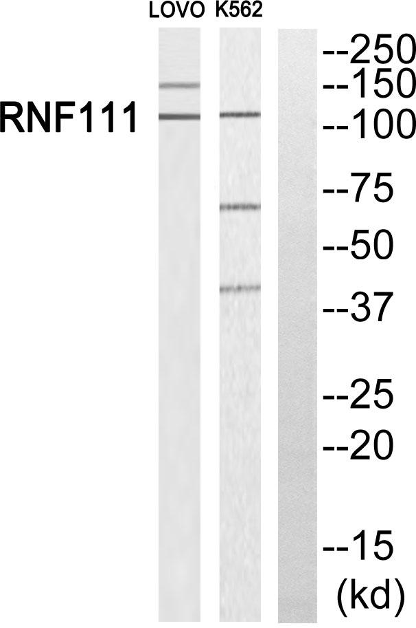 Arkadia / RNF111 Antibody - Western blot analysis of extracts from LOVO cells and K562 cells, using RNF111 antibody.