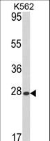 ARL1 Antibody - Western blot of hARL1-G3 in K562 cell line lysates (35 ug/lane). ARL1 (arrow) was detected using the purified antibody.