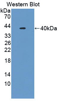 ARL1 Antibody - Western blot of ARL1 antibody.