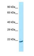 ARL1 Antibody - ARL1 antibody Western Blot of HepG2.  This image was taken for the unconjugated form of this product. Other forms have not been tested.