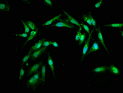 ARL1 Antibody - Immunofluorescence staining of Hela cells at a dilution of 1:100, counter-stained with DAPI. The cells were fixed in 4% formaldehyde, permeabilized using 0.2% Triton X-100 and blocked in 10% normal Goat Serum. The cells were then incubated with the antibody overnight at 4 °C.The secondary antibody was Alexa Fluor 488-congugated AffiniPure Goat Anti-Rabbit IgG (H+L) .