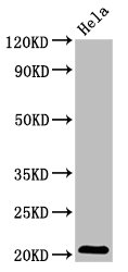 ARL1 Antibody - Western Blot Positive WB detected in: Hela whole cell lysate All lanes: ARL1 antibody at 5.1µg/ml Secondary Goat polyclonal to rabbit IgG at 1/50000 dilution Predicted band size: 21, 19 kDa Observed band size: 21 kDa