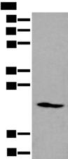 ARL1 Antibody - Western blot analysis of K562 cell lysate  using ARL1 Polyclonal Antibody at dilution of 1:550
