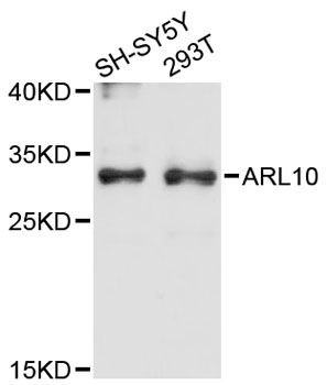 ARL10 Antibody - Western blot analysis of extracts of various cell lines, using ARL10 antibody at 1:3000 dilution. The secondary antibody used was an HRP Goat Anti-Rabbit IgG (H+L) at 1:10000 dilution. Lysates were loaded 25ug per lane and 3% nonfat dry milk in TBST was used for blocking. An ECL Kit was used for detection and the exposure time was 90s.