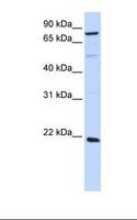 ARL11 Antibody - 293T cell lysate. Antibody concentration: 1.0 ug/ml. Gel concentration: 12%.  This image was taken for the unconjugated form of this product. Other forms have not been tested.