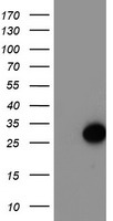 ARL11 Antibody - HEK293T cells were transfected with the pCMV6-ENTRY control (Left lane) or pCMV6-ENTRY ARL11 (Right lane) cDNA for 48 hrs and lysed. Equivalent amounts of cell lysates (5 ug per lane) were separated by SDS-PAGE and immunoblotted with anti-ARL11.