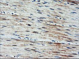ARL11 Antibody - IHC of paraffin-embedded Human colon tissue using anti-ARL11 mouse monoclonal antibody.