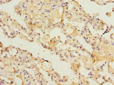 ARL11 Antibody - Immunohistochemistry of paraffin-embedded human lung tissue using antibody at dilution of 1:100.