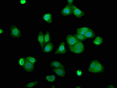 ARL11 Antibody - Immunofluorescence staining of HepG2 cells with ARL11 Antibody at 1:100, counter-stained with DAPI. The cells were fixed in 4% formaldehyde, permeabilized using 0.2% Triton X-100 and blocked in 10% normal Goat Serum. The cells were then incubated with the antibody overnight at 4°C. The secondary antibody was Alexa Fluor 488-congugated AffiniPure Goat Anti-Rabbit IgG(H+L).