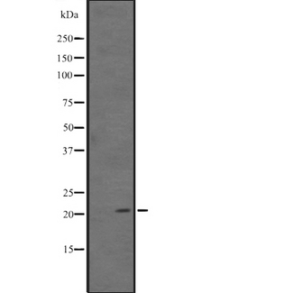 ARL11 Antibody - Western blot analysis of ARL11 expression in human kidney tissue lysate. The lane on the left is treated with the antigen-specific peptide.