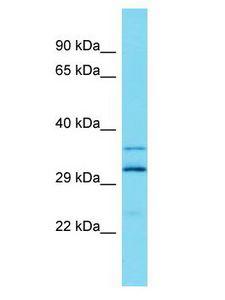 ARL13A Antibody - ARL13A antibody Western Blot of Fetal Liver. Antibody dilution: 1 ug/ml.  This image was taken for the unconjugated form of this product. Other forms have not been tested.