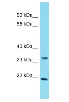 ARL13A Antibody - ARL13A antibody Western Blot of U937. Antibody dilution: 1 ug/ml.  This image was taken for the unconjugated form of this product. Other forms have not been tested.
