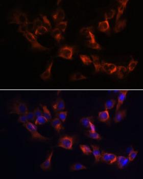 ARL13B Antibody - Immunofluorescence analysis of C6 cells using ARL13B Polyclonal Antibody at dilution of 1:100.Blue: DAPI for nuclear staining.