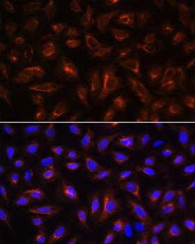 ARL13B Antibody - Immunofluorescence analysis of U-2OS cells using ARL13B Polyclonal Antibody at dilution of 1:100.Blue: DAPI for nuclear staining.