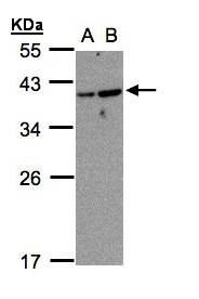 ARL14 Antibody - Sample (30 ug whole cell lysate). A: MOLT4 , B: Raji . 12% SDS PAGE. ARL14 antibody diluted at 1:1000