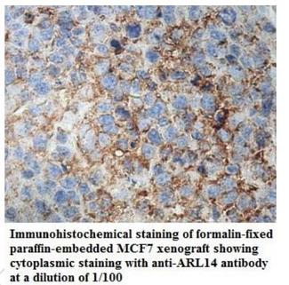 ARL14 Antibody - Immunohistochemistry of ARL14 antibody
