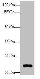 ARL14 Antibody - Western blot All lanes: ARL14 antibody at 0.3µg/ml + MCF-7 whole cell lysate Secondary Goat polyclonal to rabbit IgG at 1/10000 dilution Predicted band size: 22 kDa Observed band size: 22 kDa