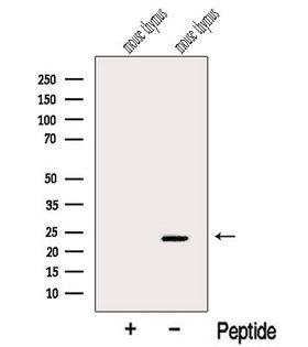 ARL15 Antibody - Western blot analysis of extracts of mouse thymus tissue using ARL15 antibody. The lane on the left was treated with blocking peptide.
