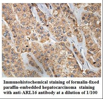 ARL16 Antibody