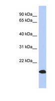 ARL17 A+B Antibody - ARL17B / ARL17 antibody Western blot of Placenta lysate. This image was taken for the unconjugated form of this product. Other forms have not been tested.