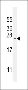 ARL17A Antibody - ARL17P1 Antibody western blot of NCI-H460 cell line lysates (35 ug/lane). The ARL17P1 antibody detected the ARL17P1 protein (arrow).