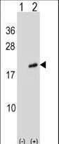 ARL2 Antibody - Western blot of ARL2 (arrow) using rabbit polyclonal ARL2 Antibody. 293 cell lysates (2 ug/lane) either nontransfected (Lane 1) or transiently transfected (Lane 2) with the ARL2 gene.