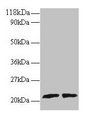 ARL2 Antibody - Western blot All lanes: ADP-ribosylation factor-like protein 2 antibody at 2µg/ml Lane 1: EC109 whole cell lysate Lane 2: 293T whole cell lysate Secondary Goat polyclonal to rabbit IgG at 1/15000 dilution Predicted band size: 21, 19 kDa Observed band size: 21 kDa