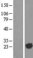 ARL2 Protein - Western validation with an anti-DDK antibody * L: Control HEK293 lysate R: Over-expression lysate