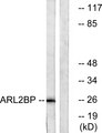 ARL2BP / BART Antibody - Western blot analysis of lysates from A549 cells, using ARL2BP Antibody. The lane on the right is blocked with the synthesized peptide.