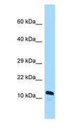 ARL2BP / BART Antibody - ARL2BP / BART antibody Western Blot of Mouse Small Intestine.  This image was taken for the unconjugated form of this product. Other forms have not been tested.