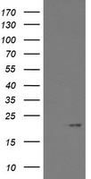 ARL2BP / BART Antibody - HEK293T cells were transfected with the pCMV6-ENTRY control (Left lane) or pCMV6-ENTRY ARL2BP (Right lane) cDNA for 48 hrs and lysed. Equivalent amounts of cell lysates (5 ug per lane) were separated by SDS-PAGE and immunoblotted with anti-ARL2BP.