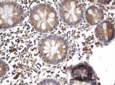 ARL2BP / BART Antibody - IHC of paraffin-embedded Human colon tissue using anti-ARL2BP mouse monoclonal antibody.