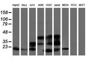 ARL2BP / BART Antibody - Western blot of extracts (35 ug) from 9 different cell lines by using anti-ARL2BP monoclonal antibody (HepG2: human; HeLa: human; SVT2: mouse; A549: human; COS7: monkey; Jurkat: human; MDCK: canine; PC12: rat; MCF7: human).