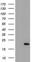 ARL2BP / BART Antibody - HEK293T cells were transfected with the pCMV6-ENTRY control (Left lane) or pCMV6-ENTRY ARL2BP (Right lane) cDNA for 48 hrs and lysed. Equivalent amounts of cell lysates (5 ug per lane) were separated by SDS-PAGE and immunoblotted with anti-ARL2BP.