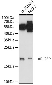 ARL2BP / BART Antibody - Western blot analysis of extracts of various cell lines, using ARL2BP antibody at 1:1000 dilution. The secondary antibody used was an HRP Goat Anti-Rabbit IgG (H+L) at 1:10000 dilution. Lysates were loaded 25ug per lane and 3% nonfat dry milk in TBST was used for blocking. An ECL Kit was used for detection and the exposure time was 90s.