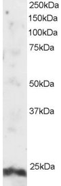 ARL4A / ARL4 Antibody - Antibody staining (2 ug/ml) of Human Testis lysate (RIPA buffer, 30 ug total protein per lane). Primary incubated for 1 hour. Detected by Western blot of chemiluminescence.