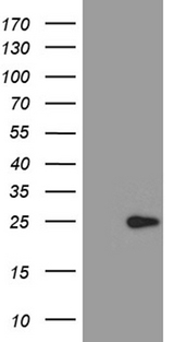 ARL4A / ARL4 Antibody - HEK293T cells were transfected with the pCMV6-ENTRY control. (Left lane) or pCMV6-ENTRY ARL4A. (Right lane) cDNA for 48 hrs and lysed. Equivalent amounts of cell lysates. (5 ug per lane) were separated by SDS-PAGE and immunoblotted with anti-ARL4A. (1:500)